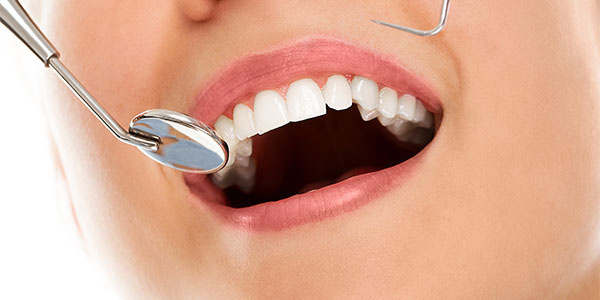 dental implant in bangalore