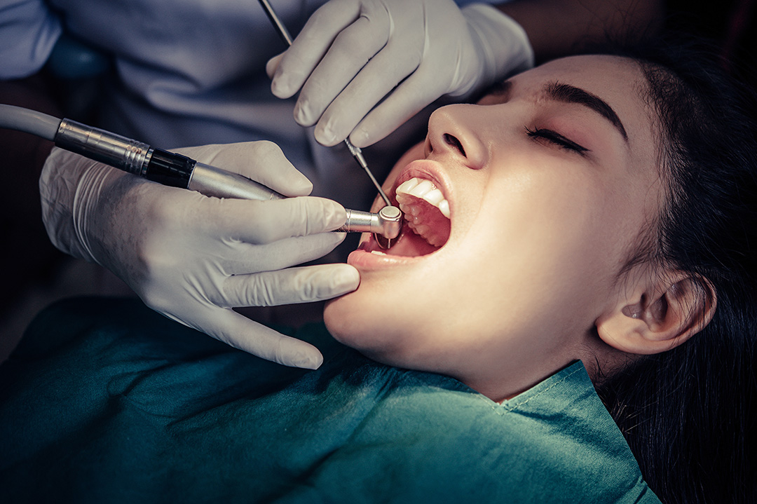Root Canal Treatment in Bangalore